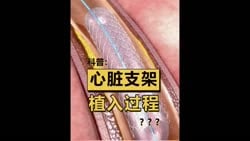 1747013712379.webm