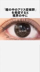4464 KB